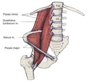 Back Pain - Courtesy of the Iliopsoas Muscle